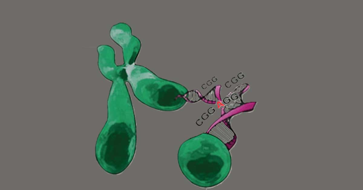 Illustration interpretation of the X Chromosome with an expanded area showing CGG repeats.