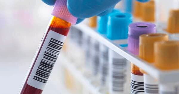 Blood in test tube held by tester