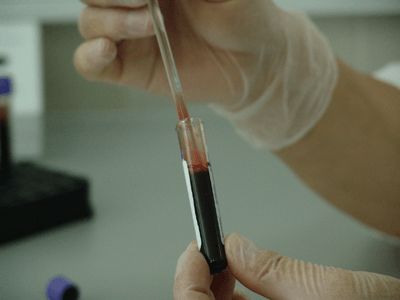 Geneticist conducting blood test.