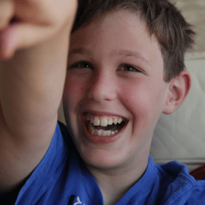 Happy smiling child with Fragile X syndrome