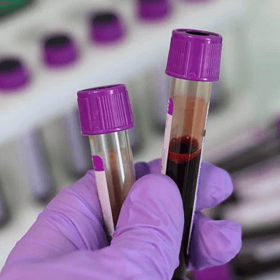 Hands in purple latex gloves holding 2 test tubes